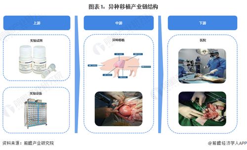 重大里程碑 科學家首次將豬肝移植到人體，成功過濾血液72小時，計算機軟硬件技術開發的關鍵作用